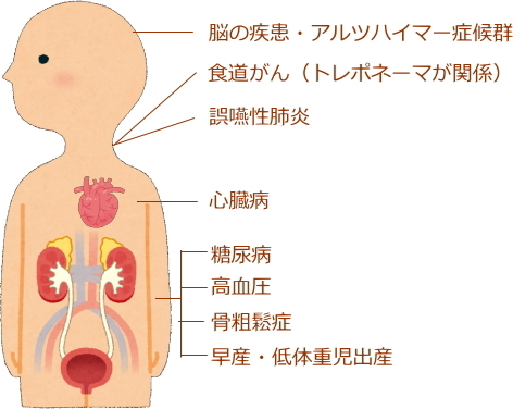 歯周病の原因となる細菌は血液を介して全身へ