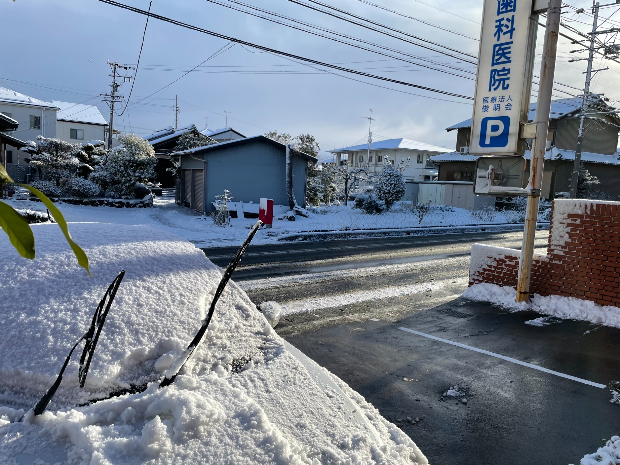 歯の構造とむし歯の基礎知識について